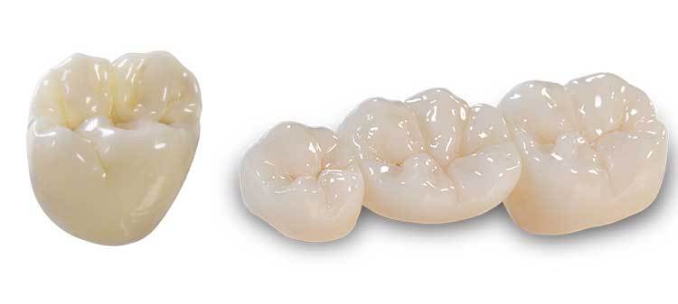 zirconia-crowns-small-bites