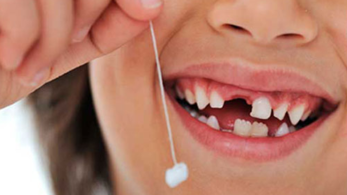 Tooth Banking : Should You Preserve Your Child’s Baby Teeth?