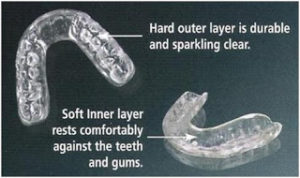 What are the Treatment for Bruxism?