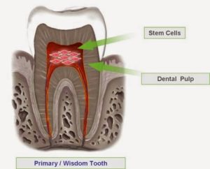 What are the advantages of Dental Pulp Stem Cells?