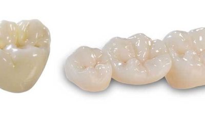 Zirconia Dental Crowns – Advantages, Procedure, Cost