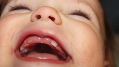 Baby Molar Teeth: Facts and Dental Care