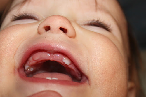 molars-teeth-what-are-they-and-how-to-take-care-of-baby-molars