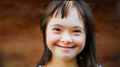 Dental Care in Children with Down Syndrome