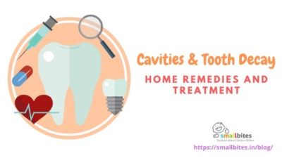 Cavities & Tooth Decay: Home Remedies and Treatment