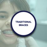 Small Bites Orthodontic Dental Services